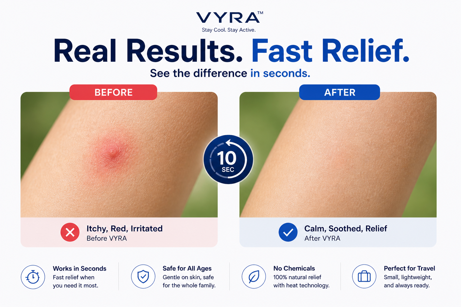 Stop the Itch in 3 Seconds - No Creams Needed